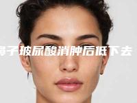 鼻子玻尿酸消肿后低下去了好多